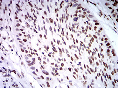 ZFP91 Antibody in Immunohistochemistry (Paraffin) (IHC (P))