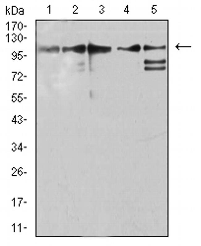 ZFP91 Antibody in Western Blot (WB)