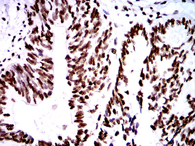 ZFP91 Antibody in Immunohistochemistry (Paraffin) (IHC (P))