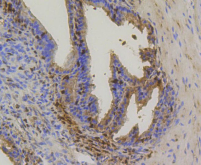 HSP70 Antibody in Immunohistochemistry (Paraffin) (IHC (P))