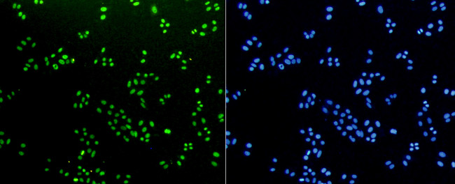 H3K18me1 Antibody in Immunocytochemistry (ICC/IF)