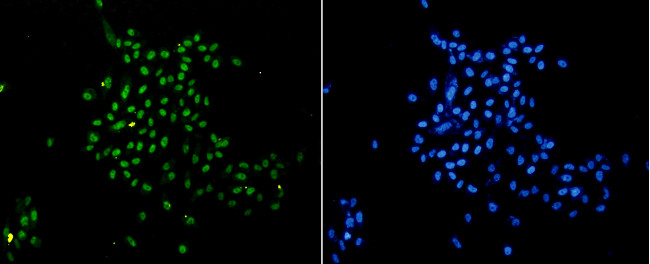 H3K18me1 Antibody in Immunocytochemistry (ICC/IF)