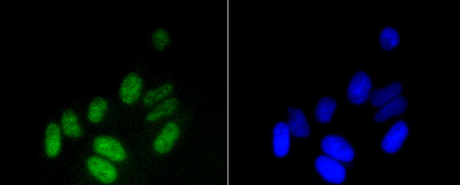 H3K18me1 Antibody in Immunocytochemistry (ICC/IF)