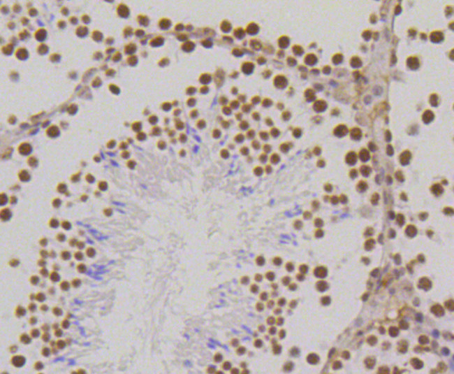 H3K18me1 Antibody in Immunohistochemistry (Paraffin) (IHC (P))