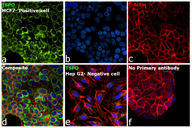 TSPO Antibody in Immunocytochemistry (ICC/IF)