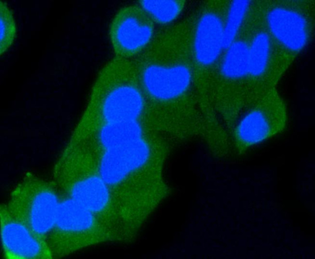 RAB9 Antibody in Immunocytochemistry (ICC/IF)