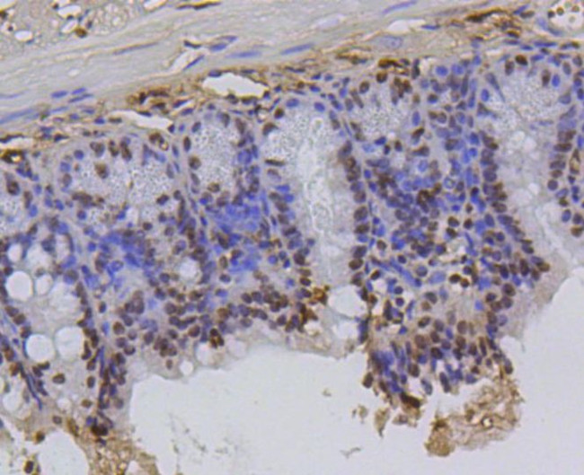 Hydroxyl-Histone H2A (Tyr39) Antibody in Immunohistochemistry (Paraffin) (IHC (P))