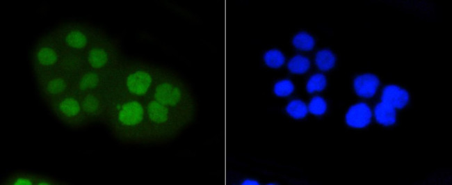 Phospho-Rb (Ser807) Antibody in Immunocytochemistry (ICC/IF)