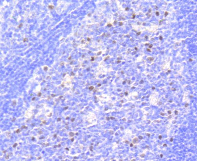 Phospho-Rb (Ser807) Antibody in Immunohistochemistry (Paraffin) (IHC (P))