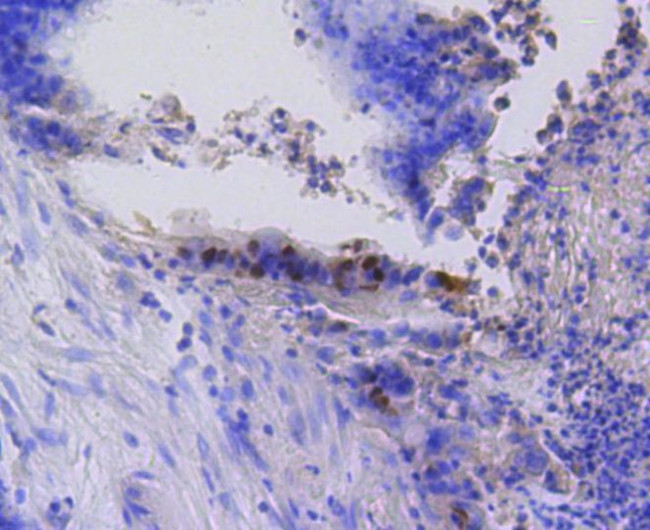 Phospho-Rb (Ser807) Antibody in Immunohistochemistry (Paraffin) (IHC (P))