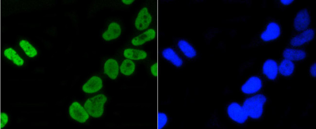 H4K5ac Antibody in Immunocytochemistry (ICC/IF)