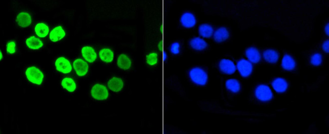 H4K5ac Antibody in Immunocytochemistry (ICC/IF)