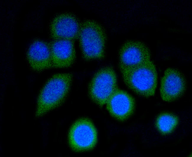 ARPC5 Antibody in Immunocytochemistry (ICC/IF)