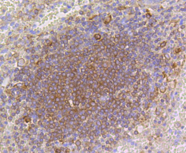 ARPC5 Antibody in Immunohistochemistry (Paraffin) (IHC (P))