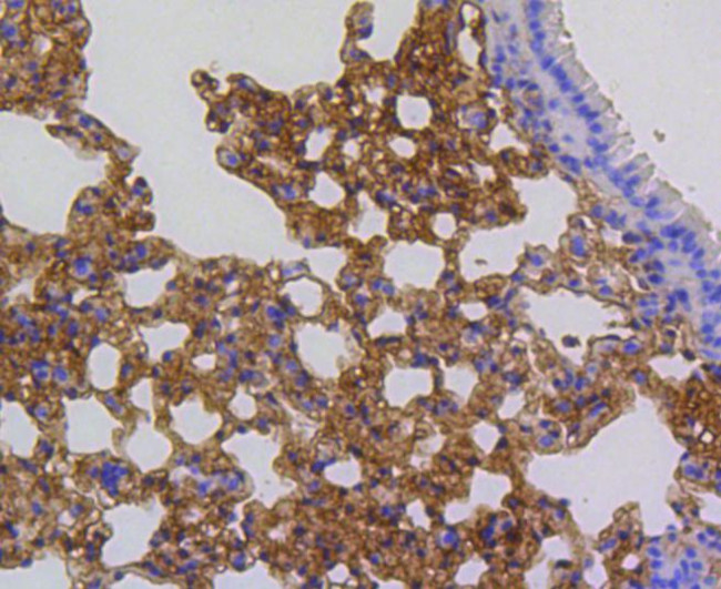 ARPC5 Antibody in Immunohistochemistry (Paraffin) (IHC (P))