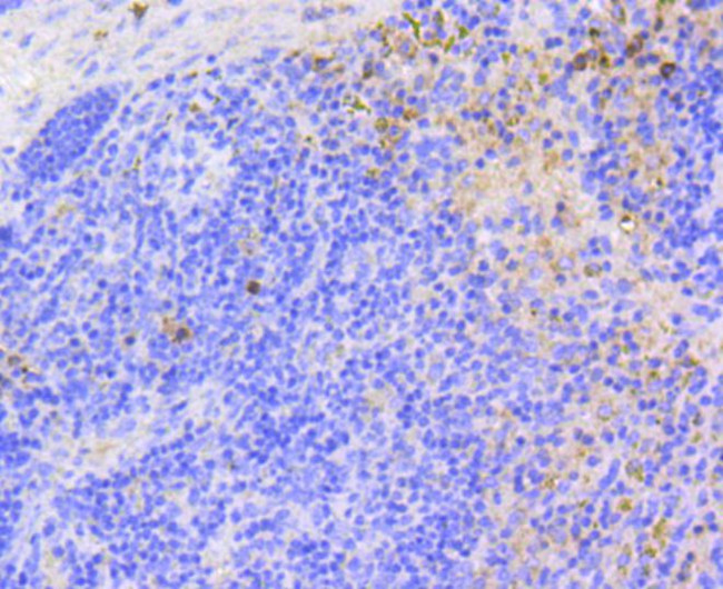 ARPC5 Antibody in Immunohistochemistry (Paraffin) (IHC (P))