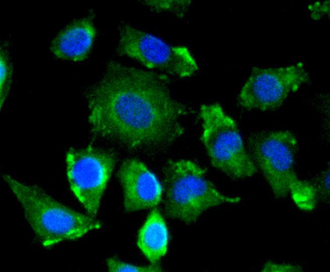 VEGF Antibody in Immunocytochemistry (ICC/IF)