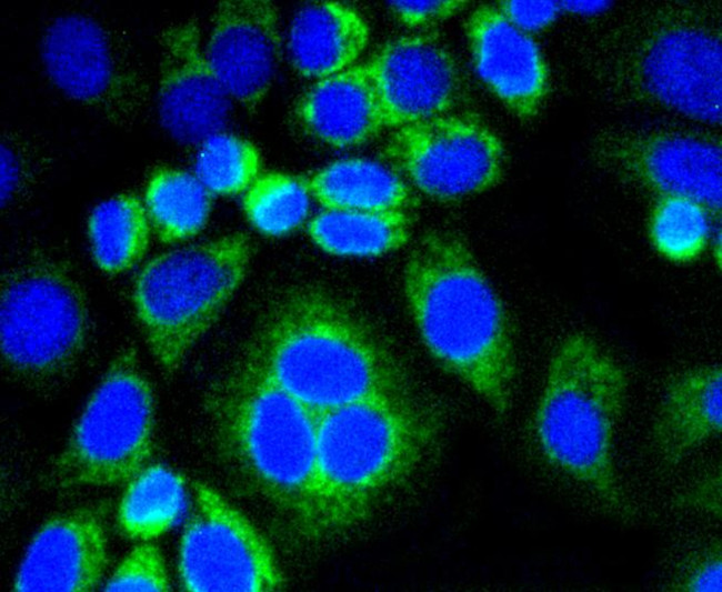 Calponin 1 Antibody in Immunocytochemistry (ICC/IF)