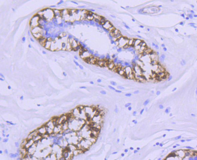 Calponin 1 Antibody in Immunohistochemistry (Paraffin) (IHC (P))