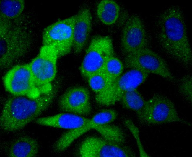 Paxillin Antibody in Immunocytochemistry (ICC/IF)