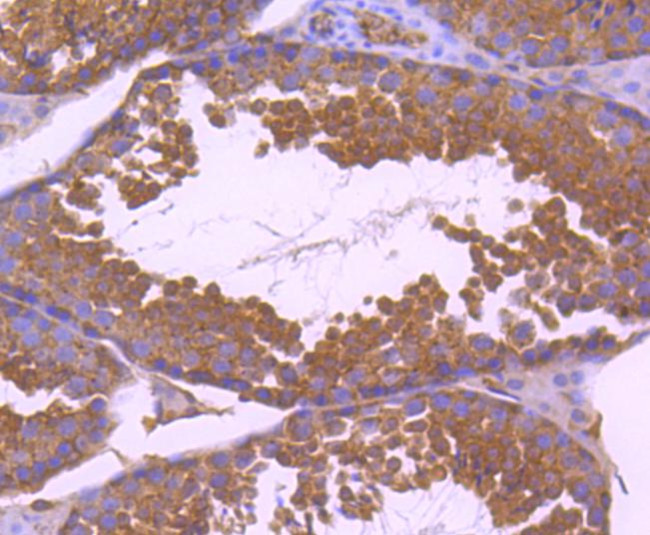 Paxillin Antibody in Immunohistochemistry (Paraffin) (IHC (P))