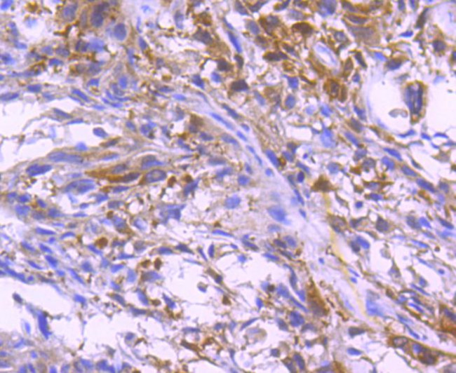 Paxillin Antibody in Immunohistochemistry (Paraffin) (IHC (P))