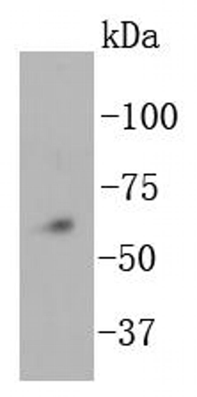 NOX4 Recombinant Monoclonal Antibody (SY0214) (MA5-32090)