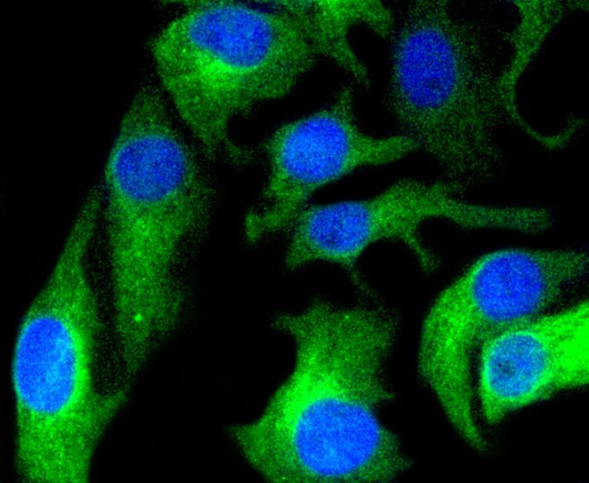 HAPLN1 Antibody in Immunocytochemistry (ICC/IF)