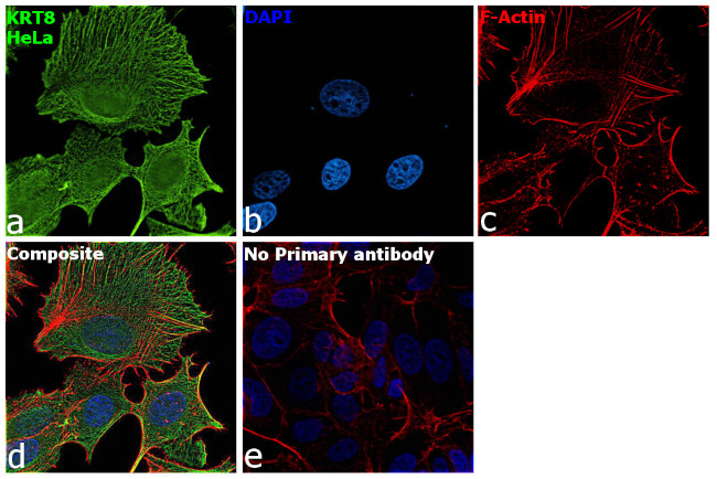 Cytokeratin 8 Antibody in Immunocytochemistry (ICC/IF)