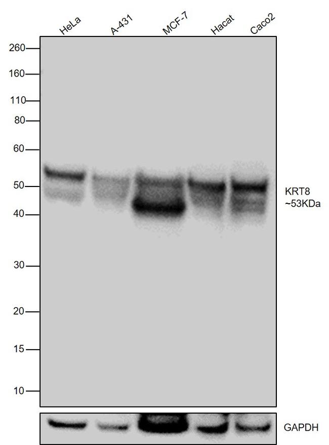 Cytokeratin 8 Recombinant Monoclonal Antibody (SU0338) (MA5-32118)