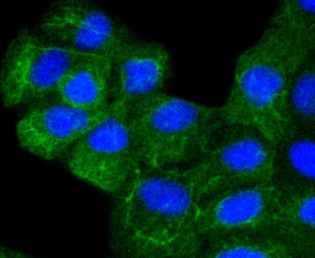 Cytokeratin 8 Recombinant Monoclonal Antibody (SU0338) (MA5-32118)