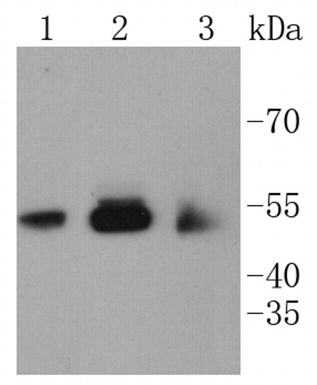 CaMKII Pan Antibody in Western Blot (WB)