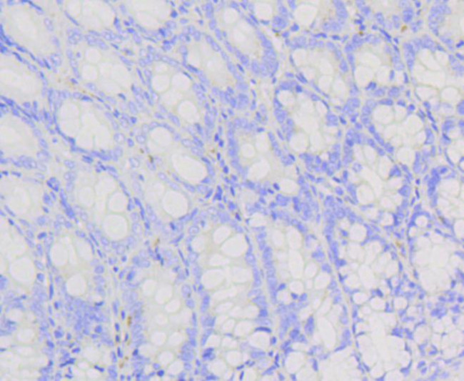 PIK3R2 Antibody in Immunohistochemistry (Paraffin) (IHC (P))