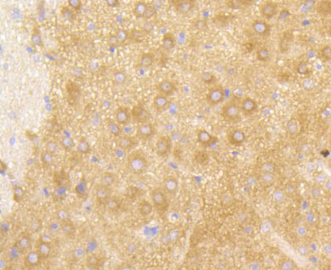 PIK3R2 Antibody in Immunohistochemistry (Paraffin) (IHC (P))