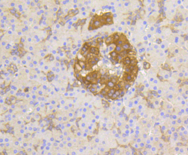 Phospho-PP2A alpha (Tyr307) Antibody in Immunohistochemistry (Paraffin) (IHC (P))