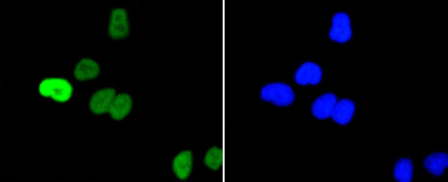 Phospho-c-Myc (Ser62) Antibody in Immunocytochemistry (ICC/IF)