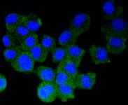 Synuclein alpha/beta Antibody in Immunocytochemistry (ICC/IF)