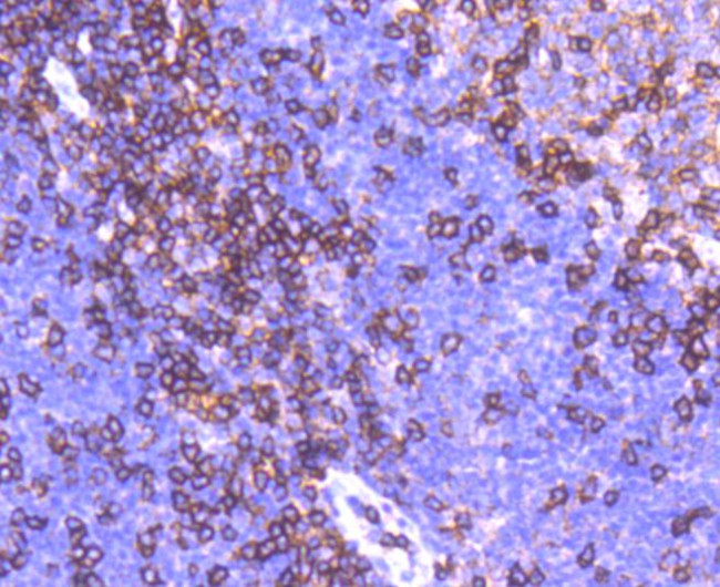 CD11a (LFA-1alpha) Antibody in Immunohistochemistry (Paraffin) (IHC (P))