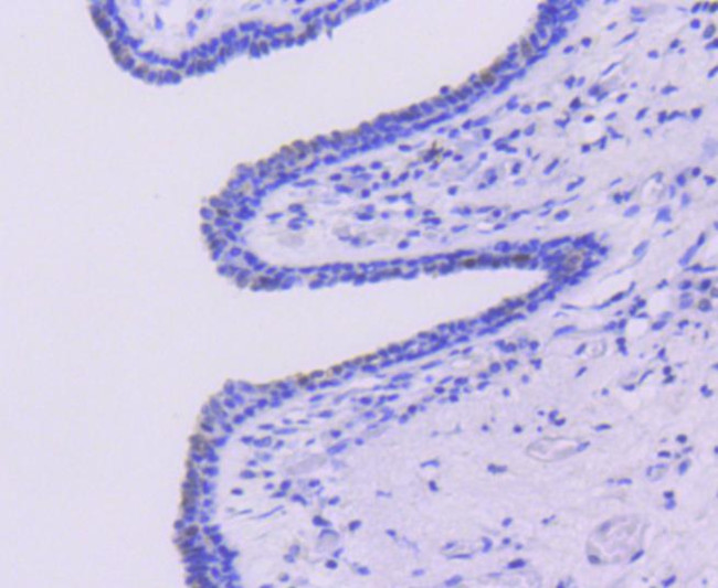 Caspase 6 Antibody in Immunohistochemistry (Paraffin) (IHC (P))