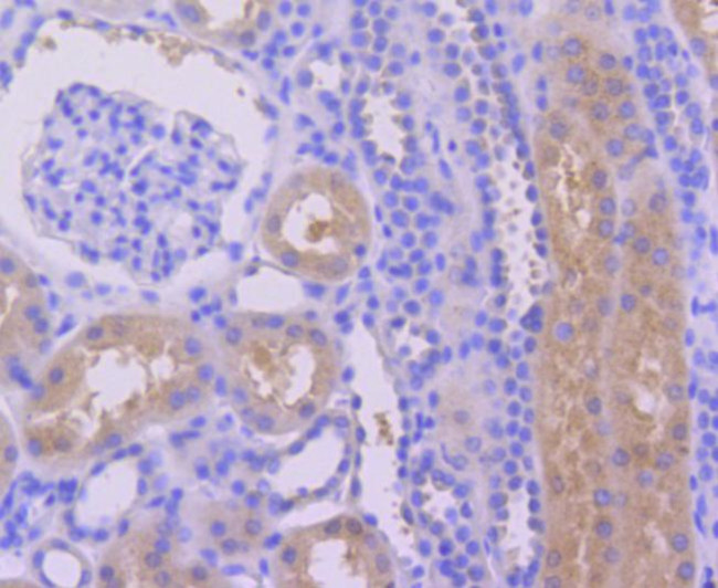 Caspase 6 Antibody in Immunohistochemistry (Paraffin) (IHC (P))