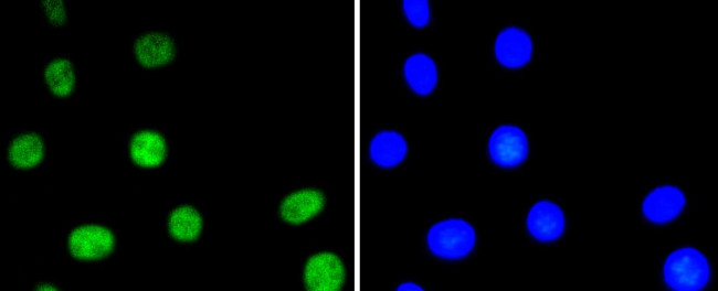 Phospho-ATF2 (Thr71) Antibody in Immunocytochemistry (ICC/IF)