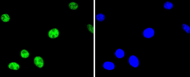 Phospho-ATF2 (Thr71) Antibody in Immunocytochemistry (ICC/IF)