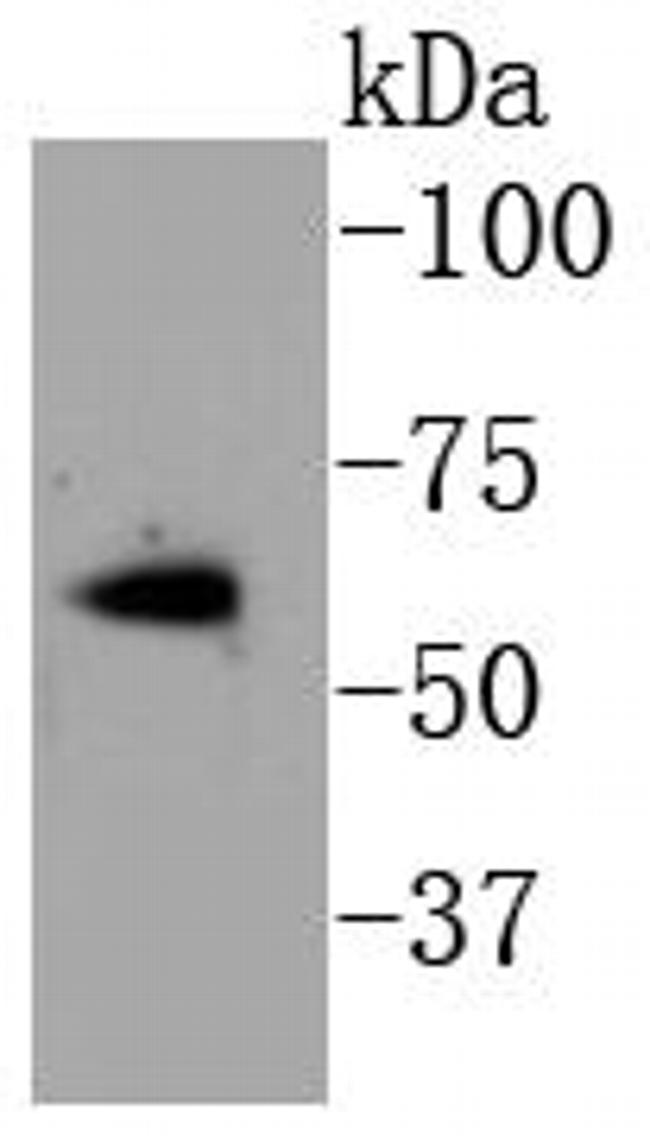 Phospho-Estrogen Receptor alpha (Ser118) Antibody in Western Blot (WB)