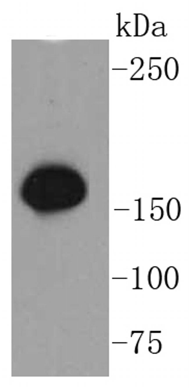 Phospho-SMC1 (Ser957) Antibody in Western Blot (WB)