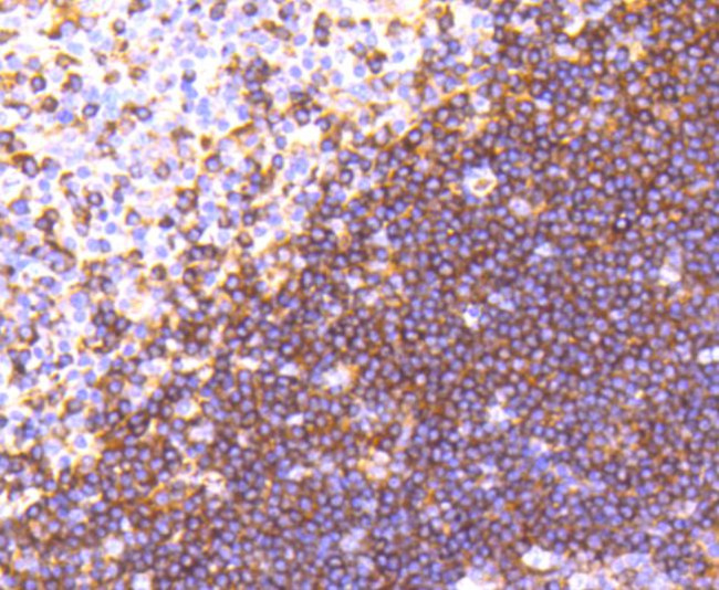 Moesin Antibody in Immunohistochemistry (Paraffin) (IHC (P))
