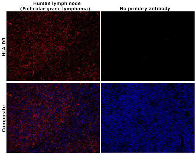HLA-DR Antibody in Immunohistochemistry (Paraffin) (IHC (P))