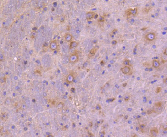 ATG9A Antibody in Immunohistochemistry (Paraffin) (IHC (P))