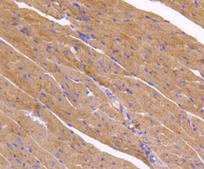 ATG9A Antibody in Immunohistochemistry (Paraffin) (IHC (P))