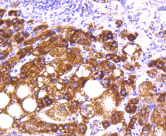 MTCO2 Antibody in Immunohistochemistry (Paraffin) (IHC (P))