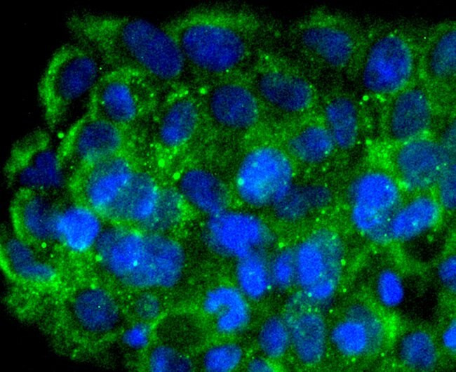 FNTB Antibody in Immunocytochemistry (ICC/IF)